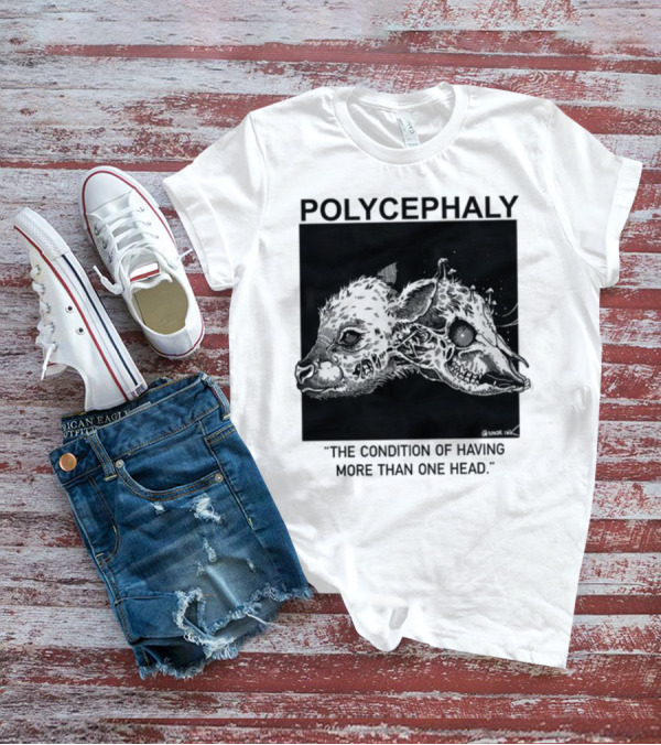 Polycephaly The Condition Of Having More Than One Head T-Shirt