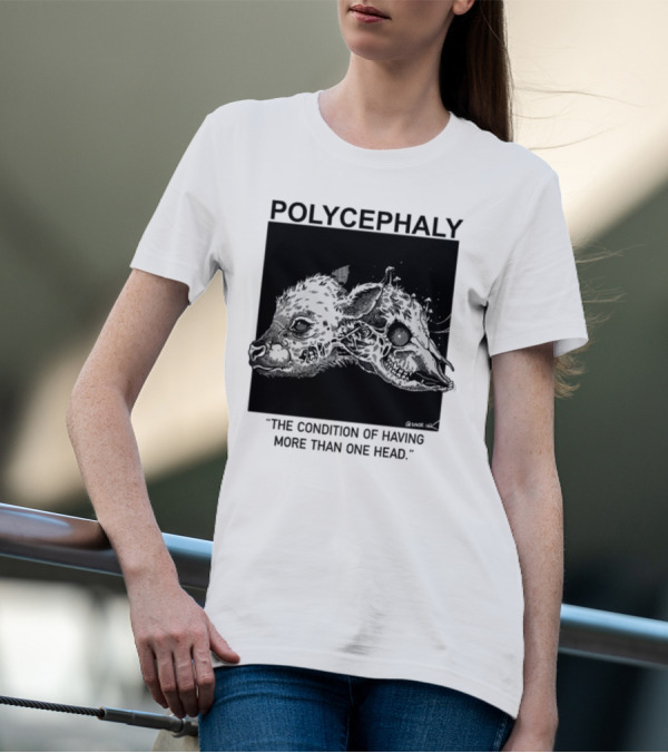 Polycephaly The Condition Of Having More Than One Head T-Shirt
