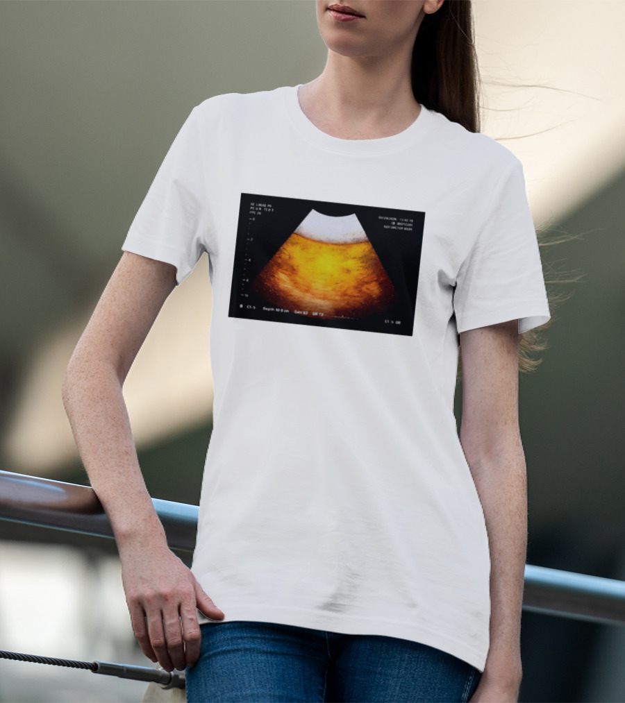 Beer Ultrasound Image Not Safe For Liver T-Shirt