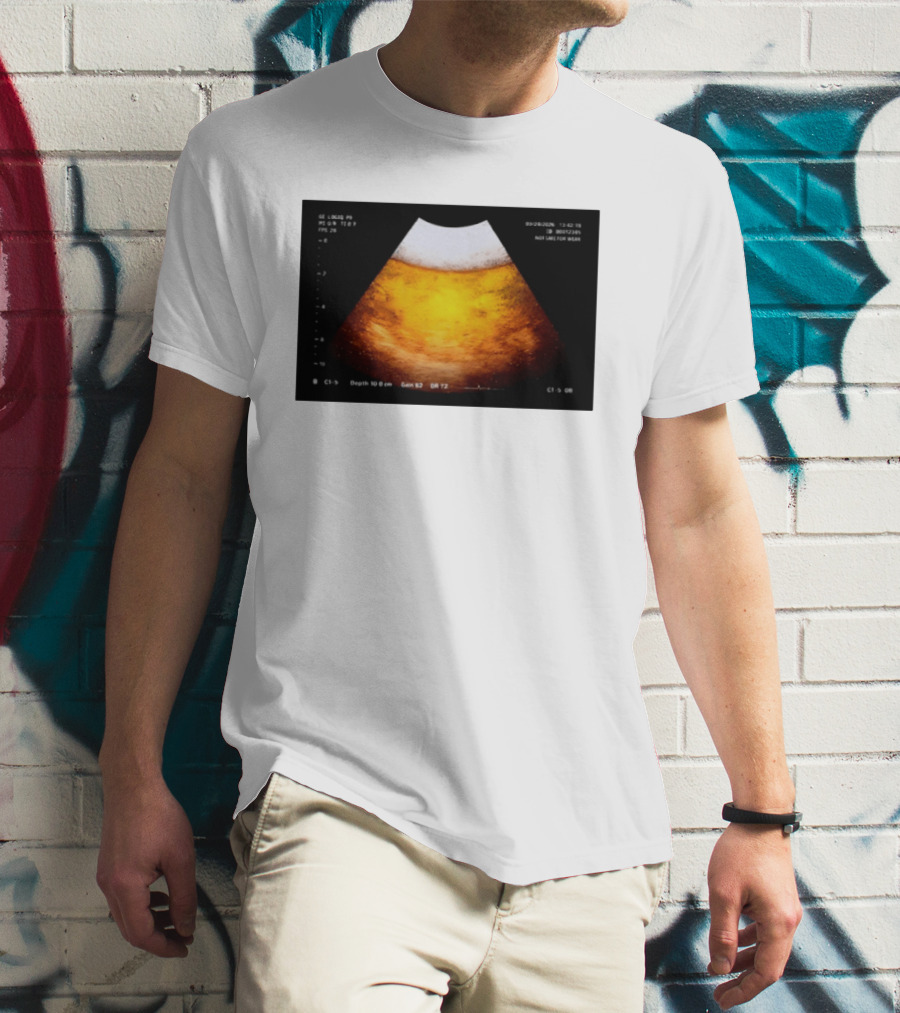 Beer Ultrasound Image Not Safe For Liver T-Shirt