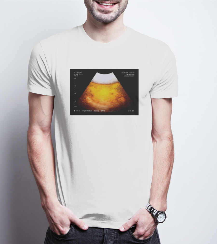 Beer Ultrasound Image Not Safe For Liver T-Shirt