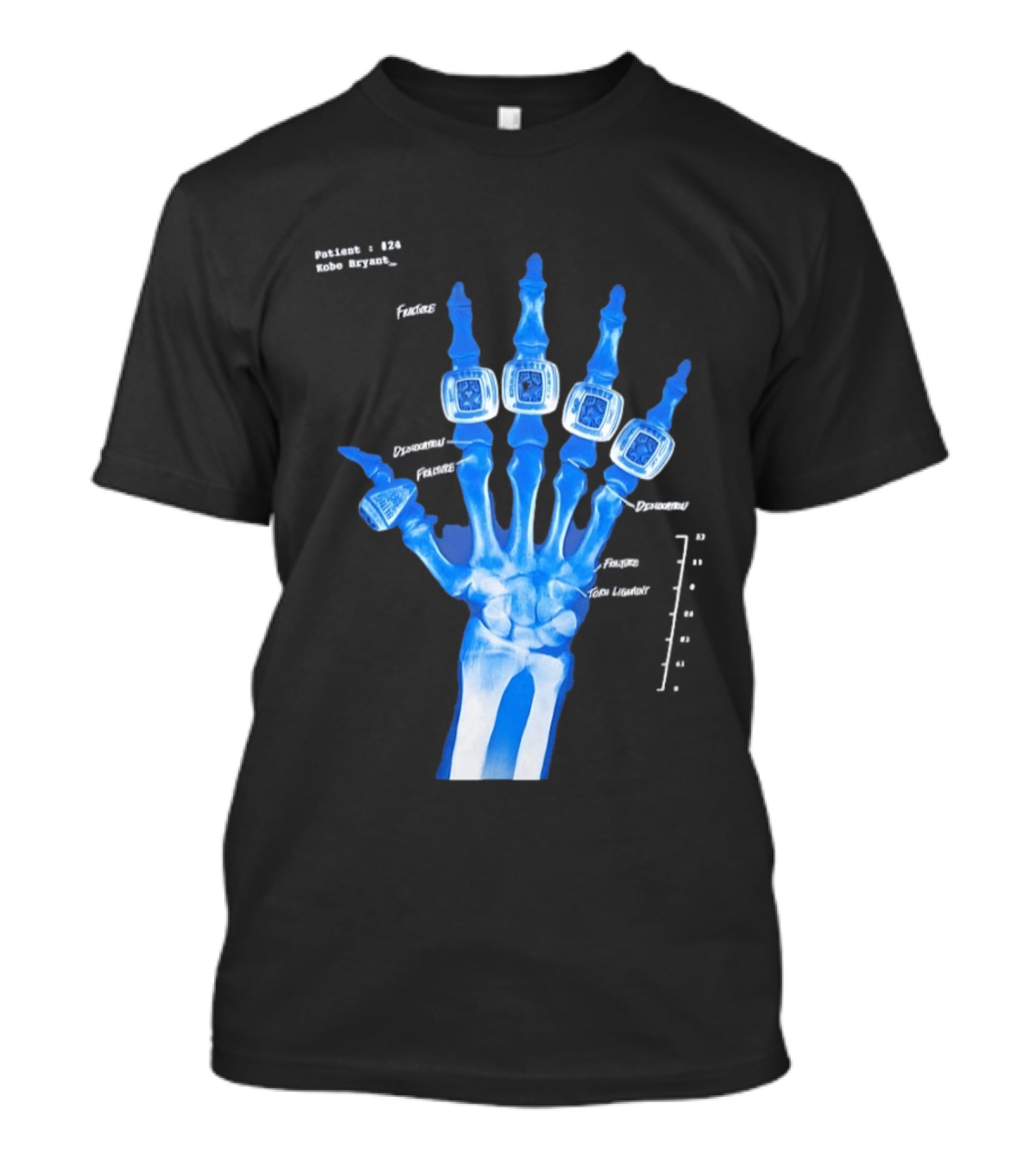 Kobe Bryant Patient No 24 X Ray Rings Lakers T-Shirt
